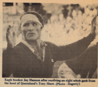 Jay Hanson all taped up after getting stomped on the head against Queensland. Photo Ed Hagerty Rugby Magazine.